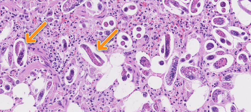 El parásito del mes: la protostrongilidosis o bronconeumonía verminosa de los pequeños rumiantes